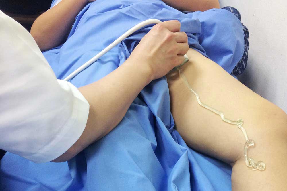 vascular-ultrasound-session-leg
