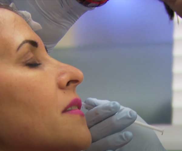 Hyaluronic Acid Injections for Youthful, Glowing Skin