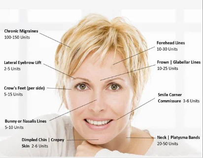 dermal-fillers