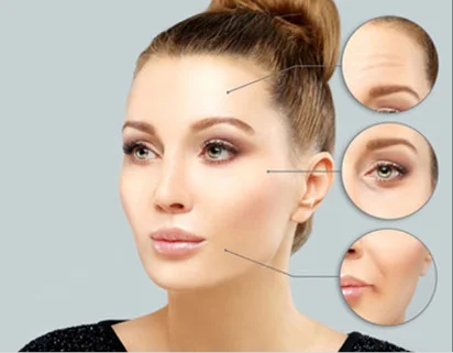 dermal-fillers