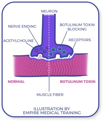 botulinum toxin effect on the muscle