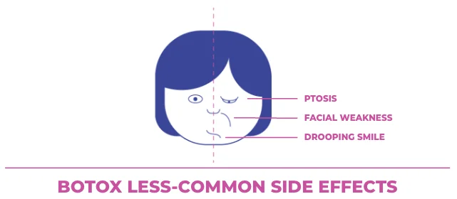 botox less common side effects