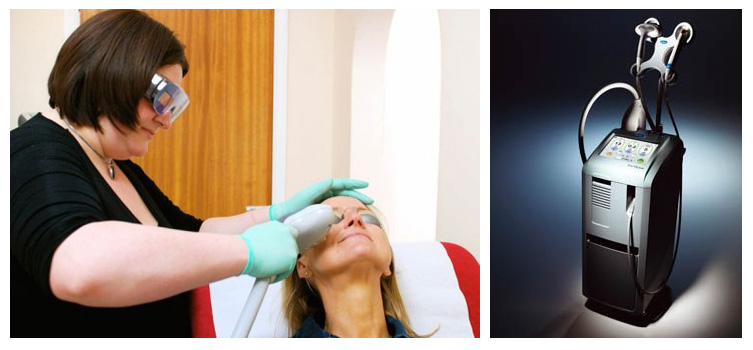 IPL treatment IPL treatment