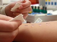 Allergy Skin Test Training Allergy Skin Test Training