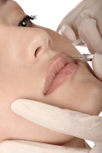 Juvederm injection