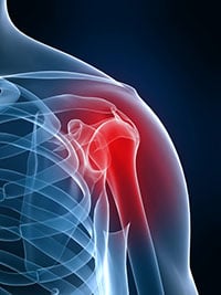 Shoulder Pain Therapies