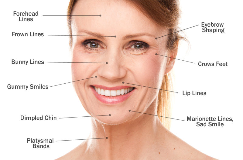 Chin treatment diagram under chin muscle diagram chin treatment diagram under chin muscle diagram