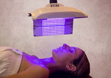 Facial Laser Treatment