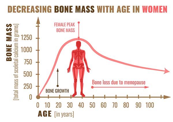 bone mass graphic in women