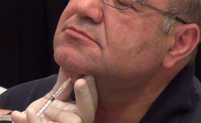 Mesotherapy Training Photo Gallery 3
