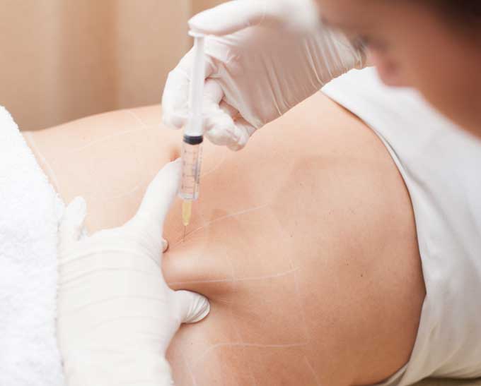 Mesotherapy Training Photo Gallery 1