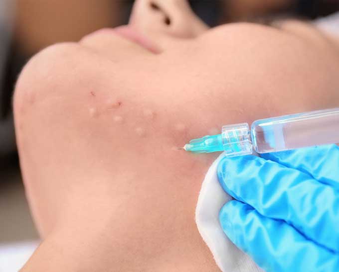 Mesotherapy Training Photo Gallery 2