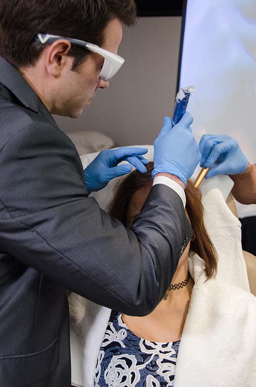 Microneedling of the Scalp during Alopecia Treatment