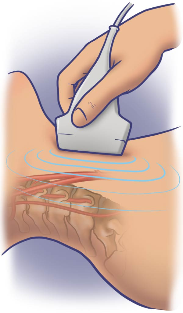 aorta-carotid-echocardiography-venous-imaging