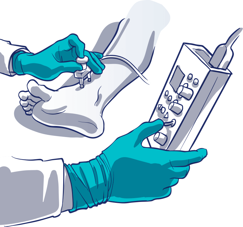 Electromyography Equipment Usage in Practice