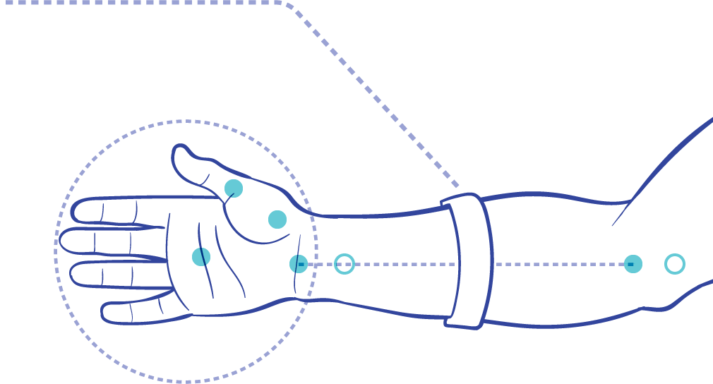 Electromyography Training Procedure Arm