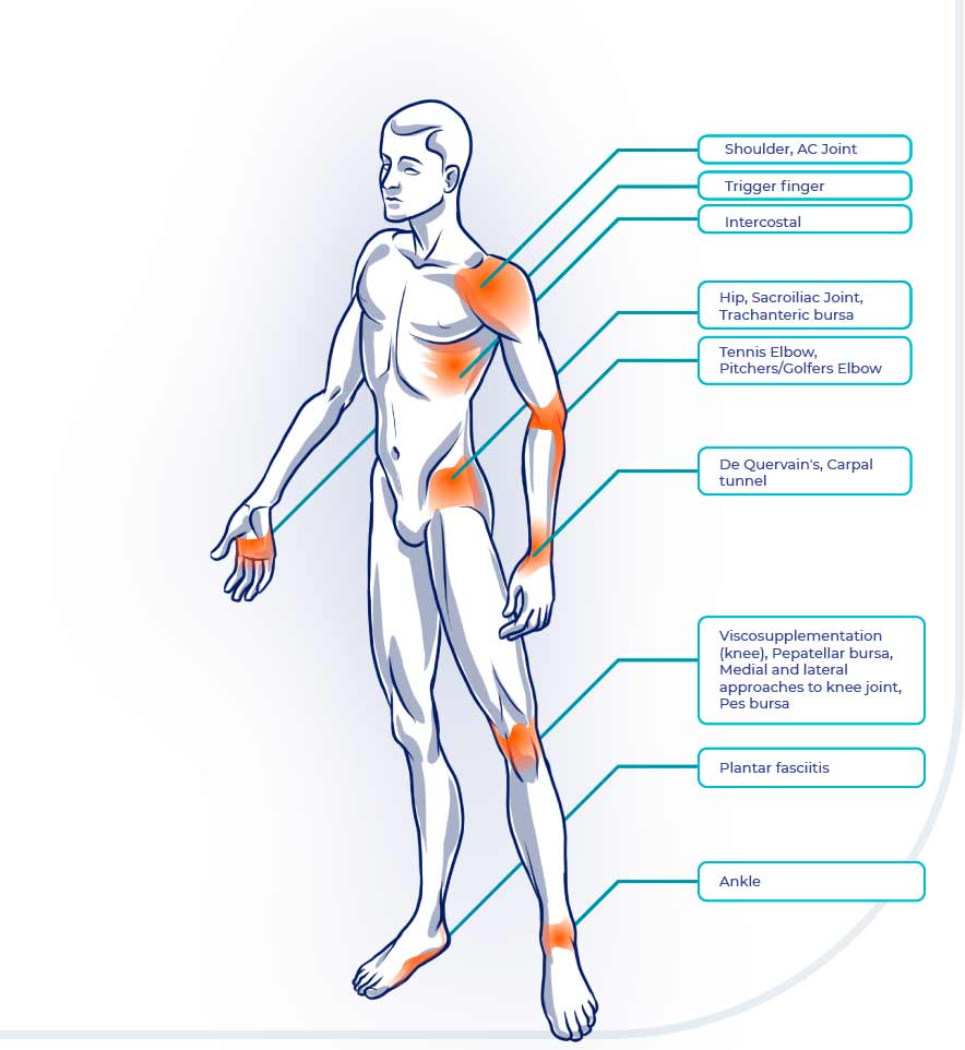 Pain Management Joint Injection Areas