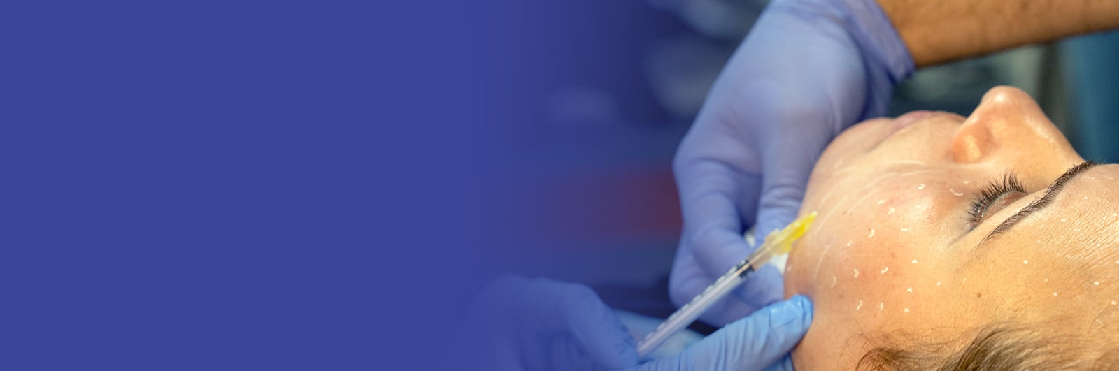 Dermal Filler Training Courses Empire Medical Training