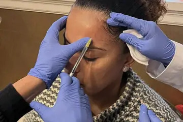 fall sale botox
