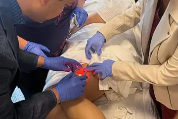 fall sale sclerotherapy