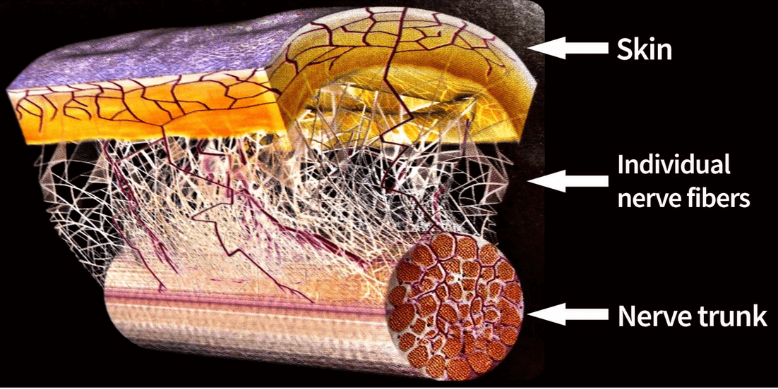 perineural-4