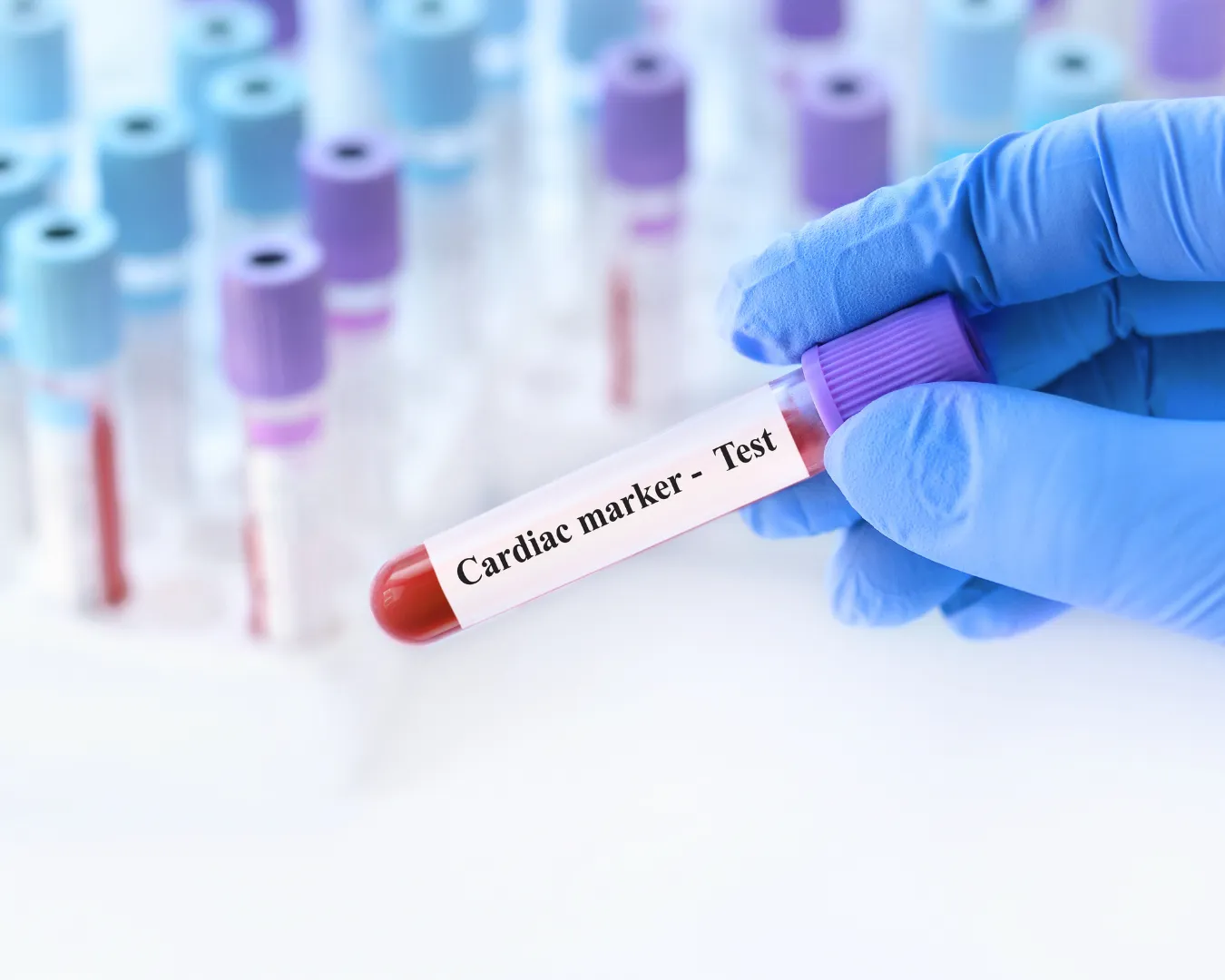 genomic-testing-photo-gallery-6