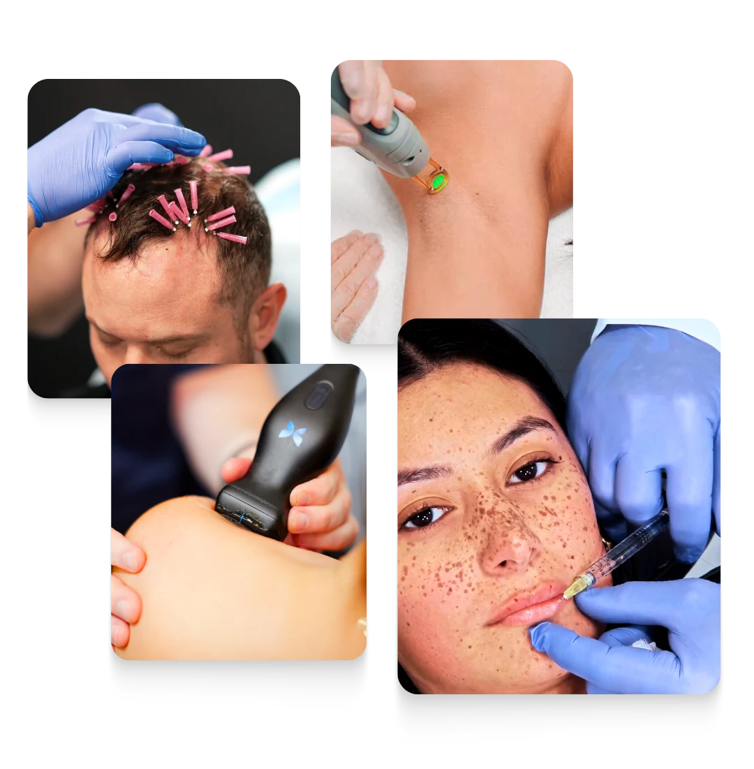 Collage of medical procedures including hair restoration with needles, laser treatment on underarm, ultrasound device on shoulder, and facial filler injection in a woman's lips – showcasing multispecialty aesthetic and medical training.