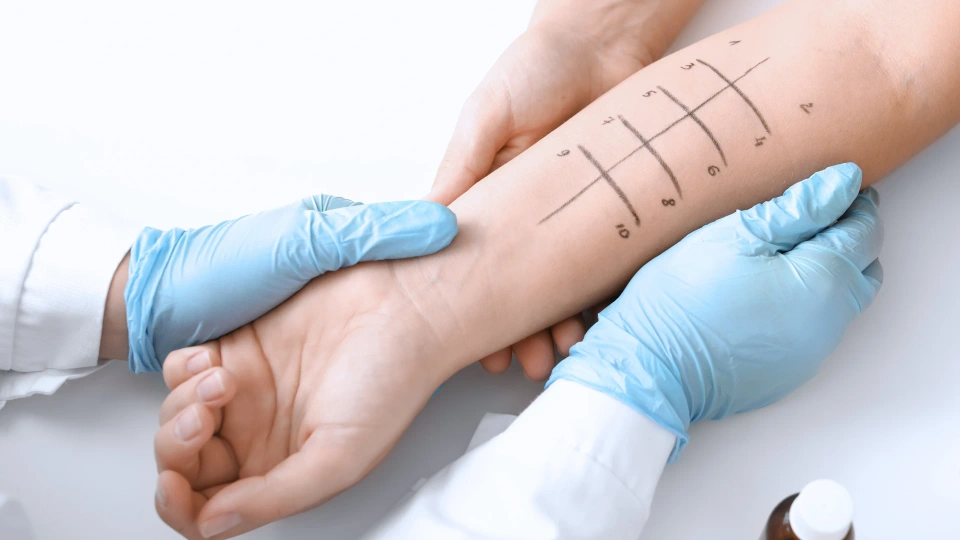 Allergy Test & Treatment Picture