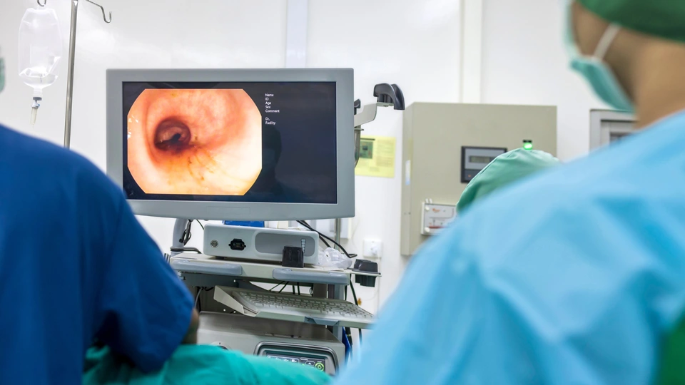 Colonoscopy Picture