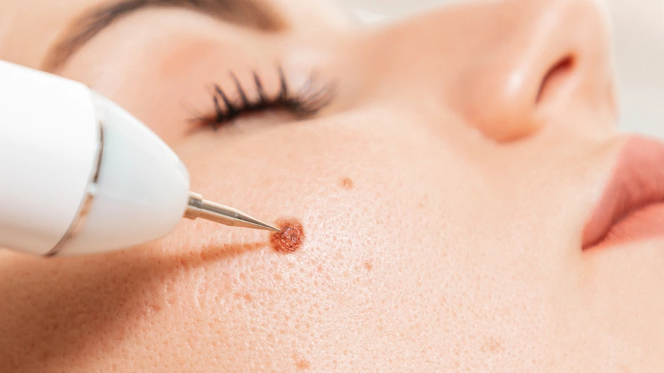 Dermatology Preceptorship Picture