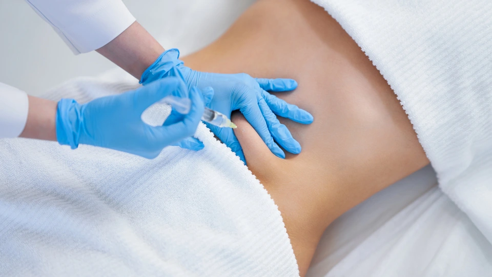 Tumescent Liposuction—Office Based Picture